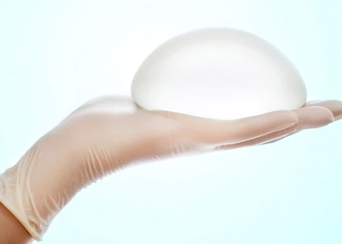 En este momento estás viendo Implantes mamarios: cinco dudas frecuentes para despejar antes de operarse